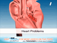 高血压|看似“无大碍”的高血压是如何一步步地损坏身体的?