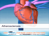 高血压|看似“无大碍”的高血压是如何一步步地损坏身体的?