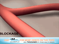 高血压|看似“无大碍”的高血压是如何一步步地损坏身体的?