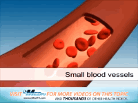 高血压|看似“无大碍”的高血压是如何一步步地损坏身体的?