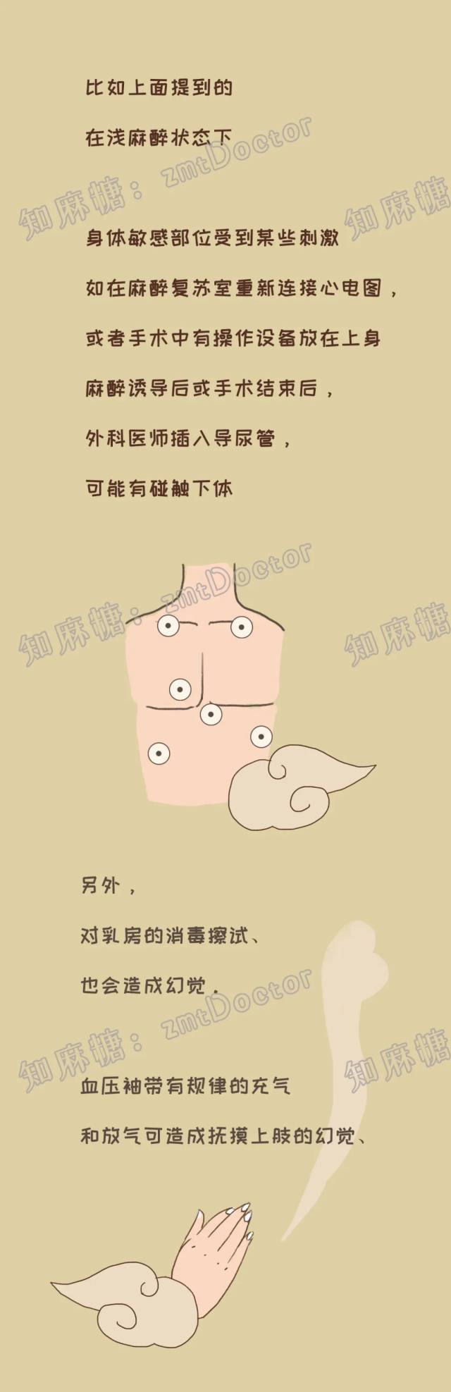 麻醉|好奇 | 躺在手术台上做梦,是什么体验?