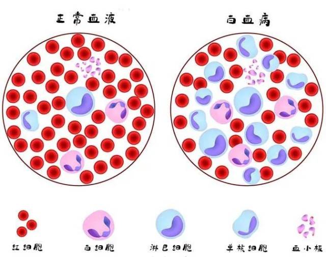 白血病|究竟什么原因让他们花钱买了“彻夜难眠”？