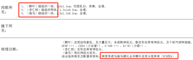 癫痫|常感莫名恐惧？肚子有股“仙气”？ 可能是颞叶癫痫哦！
