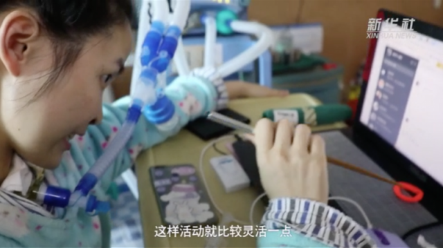 什么病用呼吸机用筷子打字鼓励病友的广东庞贝氏症女孩：与呼吸机相伴12年_https://www.jmylbn.com_新闻资讯_第5张