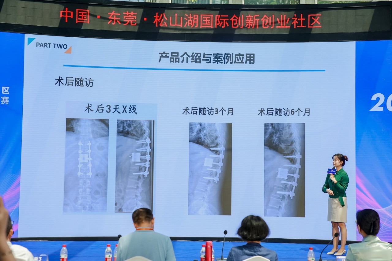 3D打印仿生型钛合金人工椎体/融合器的优化设计及临床应用项目。 3D打印仿生型钛合金人工椎体/融合器的优化设计及临床应用项目。