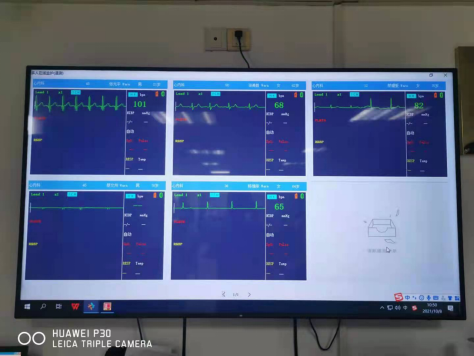 心电监护怎么看图心慌、胸痛、晕厥?别担心,长程穿戴式动态心电图为您解烦恼!_新闻资讯_第5张_活检穿刺产品网 心电监护怎么看图心慌、胸痛、晕厥?别担心,长程穿戴式动态心电图为您解烦恼!_https://www.jmylbn.com_新闻资讯_第5张