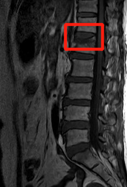 什么是牵引床年纪大了,腰酸背痛、个子变矮?万万没想到是这个原因……_新闻资讯_第3张_活检穿刺产品网 什么是牵引床年纪大了,腰酸背痛、个子变矮?万万没想到是这个原因……_https://www.jmylbn.com_新闻资讯_第3张