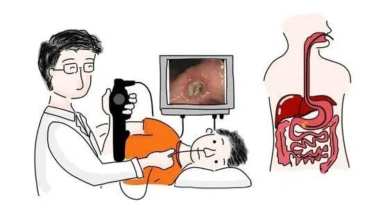 为什么要做吞咽仪器【水乡医科普】为什么要做胃镜？胃镜有何神奇之处？_https://www.jmylbn.com_新闻资讯_第4张