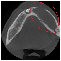 X光拍片为什么要等看牙为什么要拍片?对人体的辐射大吗?_新闻资讯_第24张_活检穿刺产品网 X光拍片为什么要等看牙为什么要拍片?对人体的辐射大吗?_https://www.jmylbn.com_新闻资讯_第24张