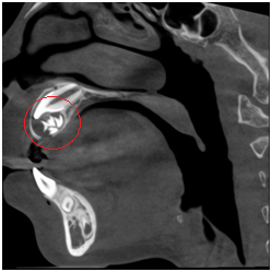 X光拍片为什么要等看牙为什么要拍片?对人体的辐射大吗?_新闻资讯_第23张_活检穿刺产品网 X光拍片为什么要等看牙为什么要拍片?对人体的辐射大吗?_https://www.jmylbn.com_新闻资讯_第23张