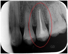 X光拍片为什么要等看牙为什么要拍片?对人体的辐射大吗?_新闻资讯_第11张_活检穿刺产品网 X光拍片为什么要等看牙为什么要拍片?对人体的辐射大吗?_https://www.jmylbn.com_新闻资讯_第11张