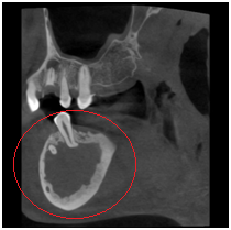 X光拍片为什么要等看牙为什么要拍片?对人体的辐射大吗?_新闻资讯_第25张_活检穿刺产品网 X光拍片为什么要等看牙为什么要拍片?对人体的辐射大吗?_https://www.jmylbn.com_新闻资讯_第25张