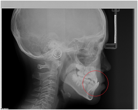 X光拍片为什么要等看牙为什么要拍片?对人体的辐射大吗?_新闻资讯_第18张_活检穿刺产品网 X光拍片为什么要等看牙为什么要拍片?对人体的辐射大吗?_https://www.jmylbn.com_新闻资讯_第18张