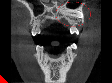 X光拍片为什么要等看牙为什么要拍片?对人体的辐射大吗?_新闻资讯_第21张_活检穿刺产品网 X光拍片为什么要等看牙为什么要拍片?对人体的辐射大吗?_https://www.jmylbn.com_新闻资讯_第21张