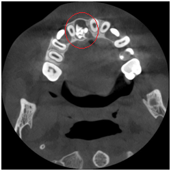 X光拍片为什么要等看牙为什么要拍片?对人体的辐射大吗?_新闻资讯_第22张_活检穿刺产品网 X光拍片为什么要等看牙为什么要拍片?对人体的辐射大吗?_https://www.jmylbn.com_新闻资讯_第22张