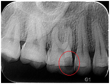 X光拍片为什么要等看牙为什么要拍片?对人体的辐射大吗?_新闻资讯_第10张_活检穿刺产品网 X光拍片为什么要等看牙为什么要拍片?对人体的辐射大吗?_https://www.jmylbn.com_新闻资讯_第10张