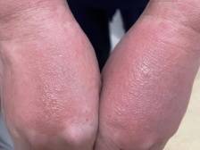 今天，请记住这双手