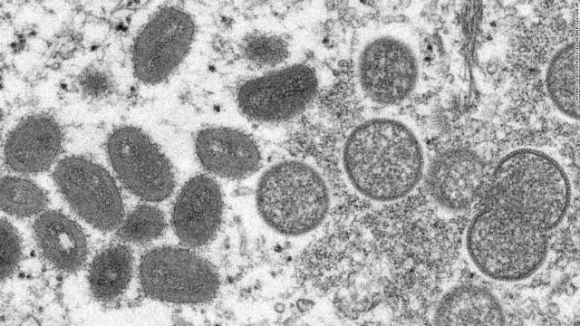 猴痘病毒。资料图片