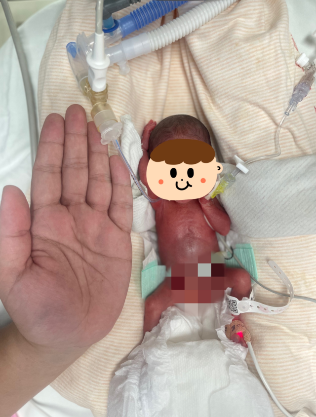刚出生时的小馨