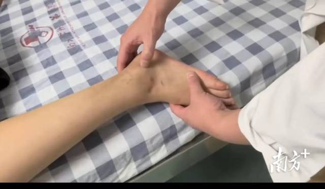 手術(shù)切口僅幾毫米,。 手術(shù)切口僅幾毫米,。