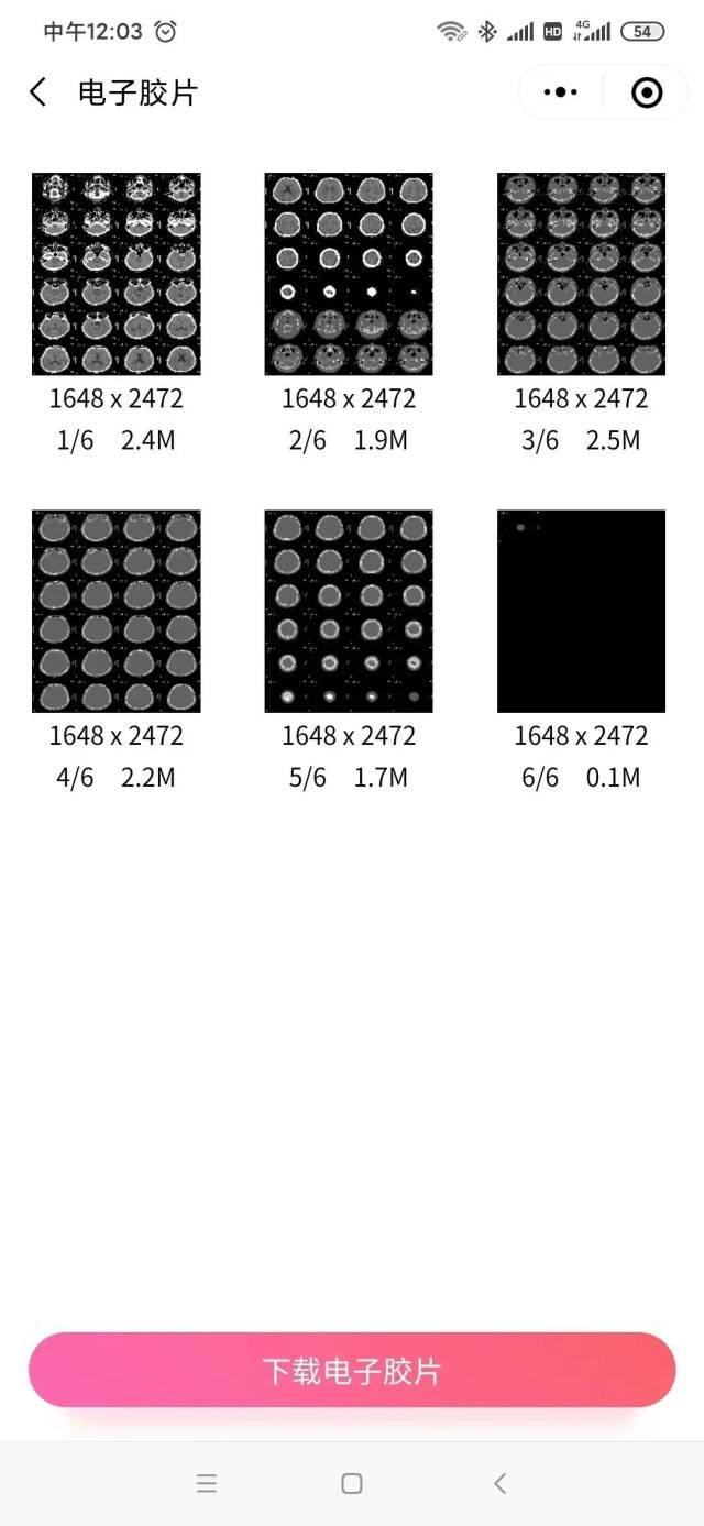 怎么自助取胶片医院＞＂ id=＂articleTitle＂ data-columnid=＂75＂＞与传统胶片说再见！广东医科大学附属医院“云胶片”系统上线_https://www.jmylbn.com_新闻资讯_第8张