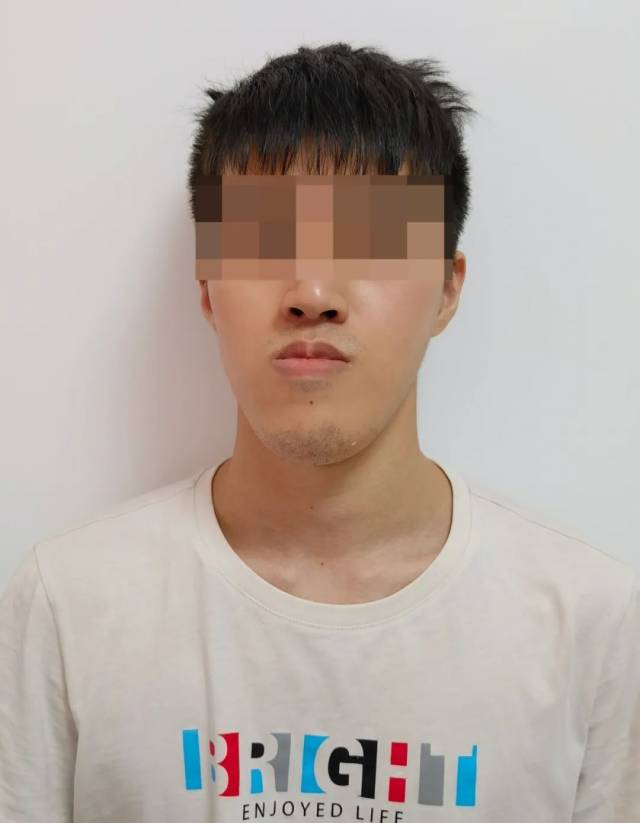 术前正面图