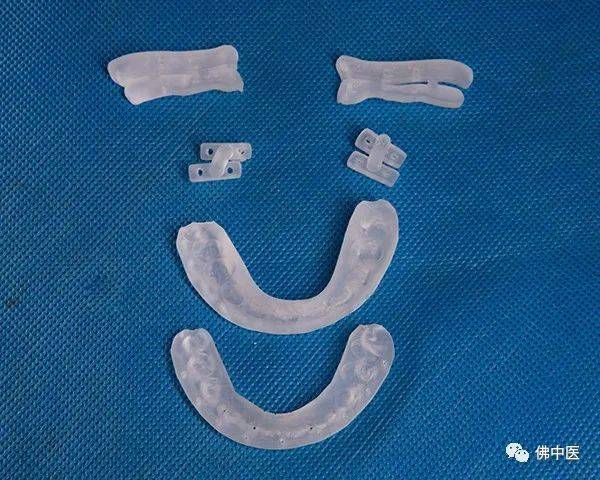 3D打印的头骨及手术导板