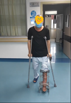 患者下地康复锻炼 患者下地康复锻炼