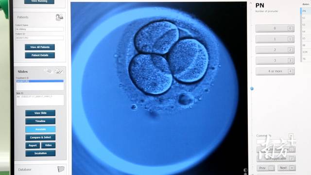 胚胎实验室内的仪器，观察胚胎发育情况。  南方+ 陈少宏 拍摄