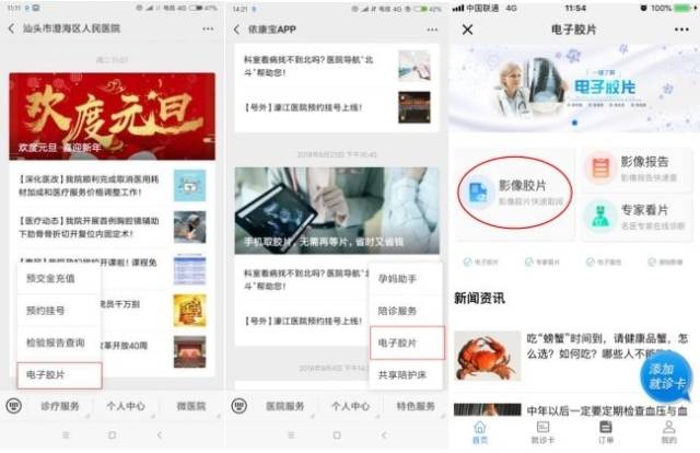怎么自助取胶片医院【便捷服务】影像检查云报告和线下自助打印为您提供便捷高效服务!_https://www.jmylbn.com_新闻资讯_第1张