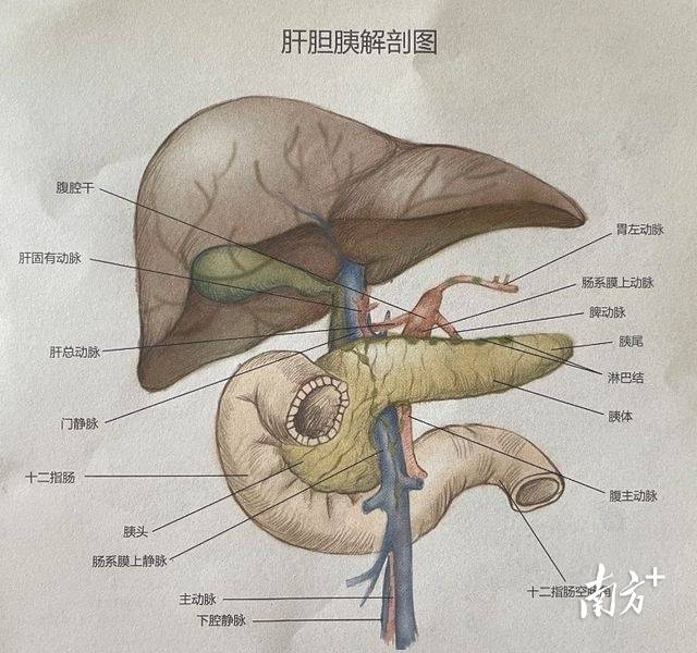 体检查出胰头良性肿瘤,还能保住十二指肠吗?_南方网