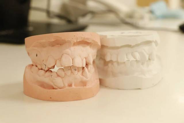 正畸颊面管是什么答患者问 | 取模时误食牙模材料,有毒吗?_新闻资讯_第2张_活检穿刺产品网 正畸颊面管是什么答患者问 | 取模时误食牙模材料,有毒吗?_https://www.jmylbn.com_新闻资讯_第2张