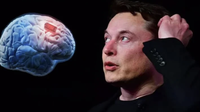 探科技|马斯克让猴子用意念打字，未来真能靠“想”搞定一切？