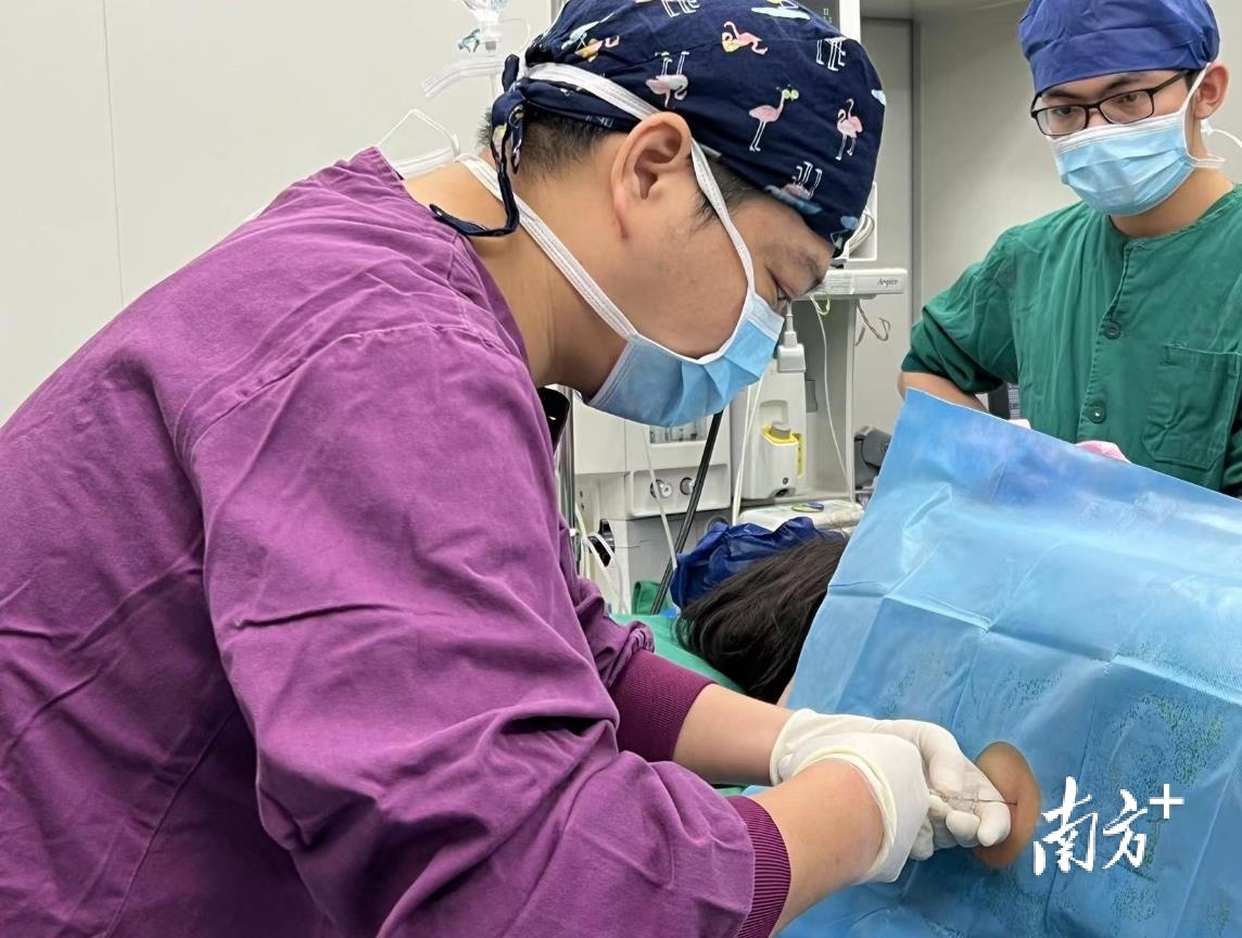 茂名市人民医院麻醉手术科副主任医师莫朴为产妇实施“半身麻醉”。