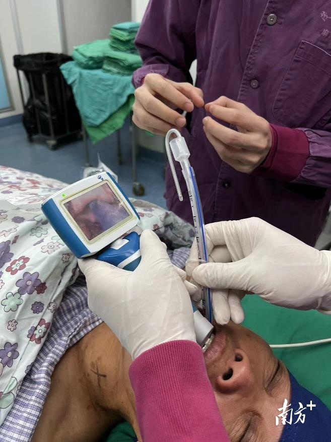 茂名市人民医院麻醉手术科副主任何景培医生快速准确将气管导管置入吴婆婆气道。