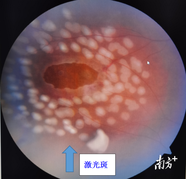 通讯员 二医 供图