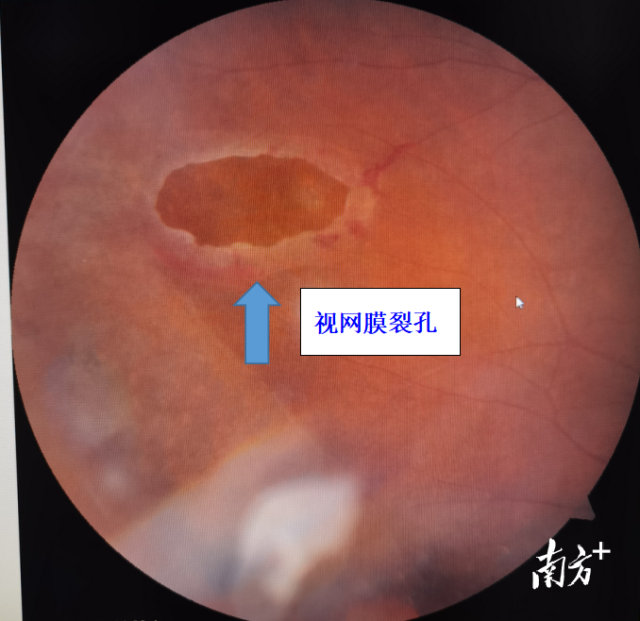 通讯员 二医 供图