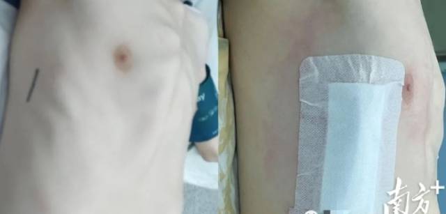 通讯员 二医 供图