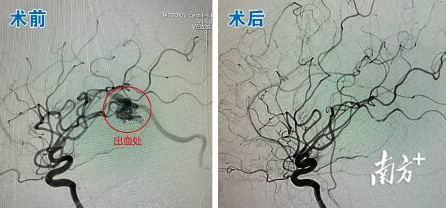 通讯员 高医 供图