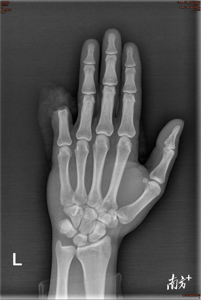 通讯员 一院 供图