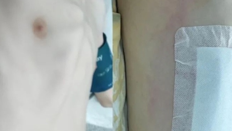 因为这种疾病，他自卑厌学痛失高考！