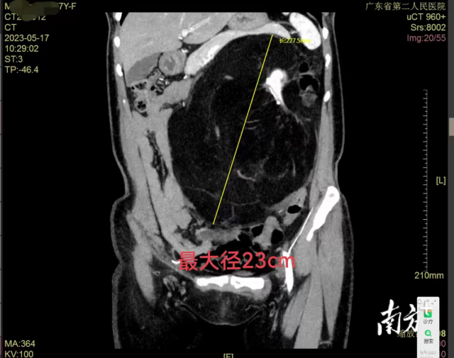 通讯员 二医 供图