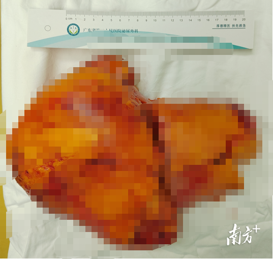 通讯员 二医 供图