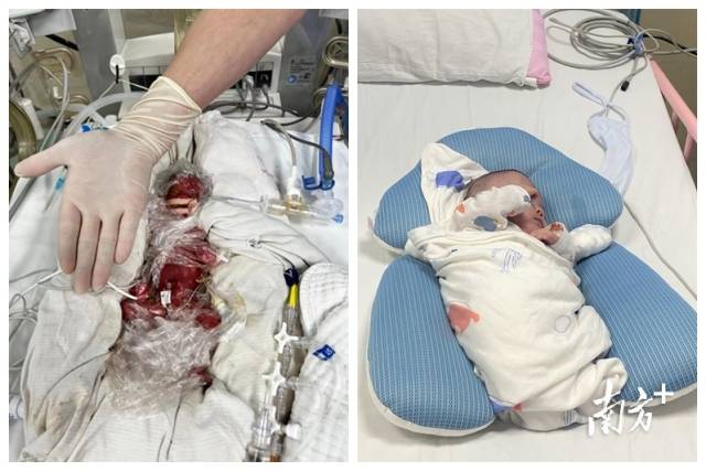 年年出生时仅有成人巴掌大小，如今已长成胖娃娃了。  