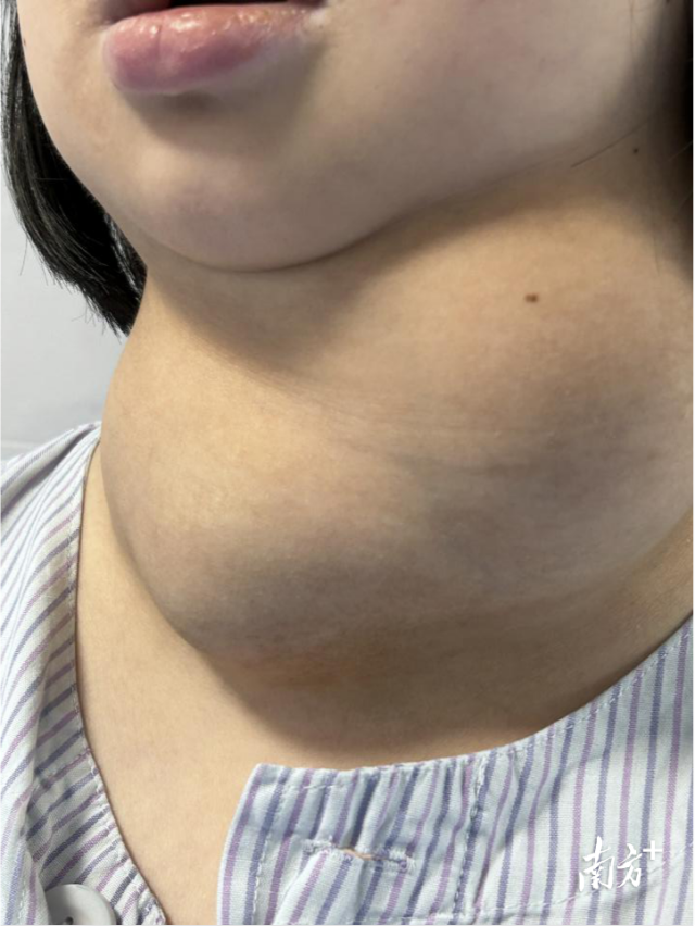 通讯员 二医 供图