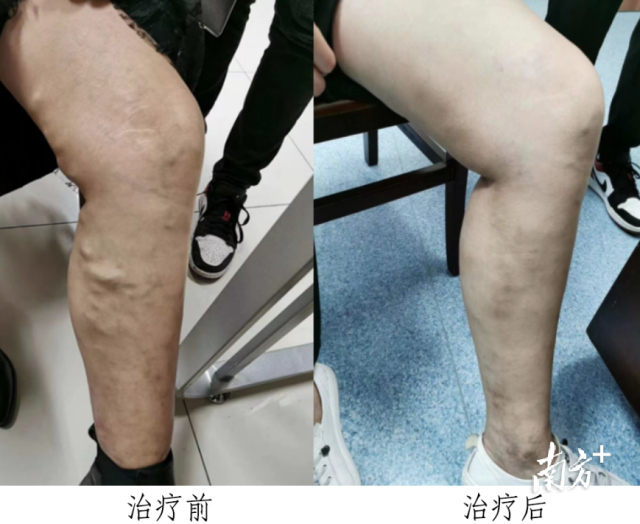 通讯员 省二医 供图