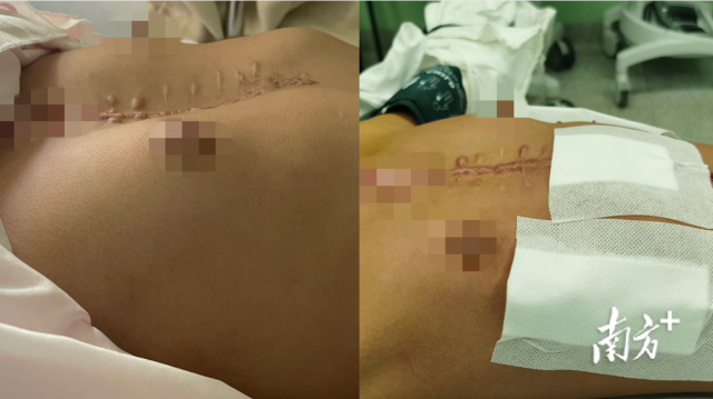 通讯员 二医 供图