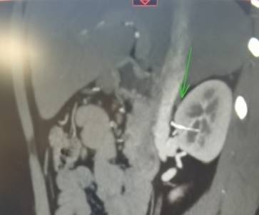 通讯员 华侨医院 供图