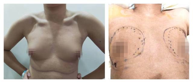 手术前后对比。  受访者供图