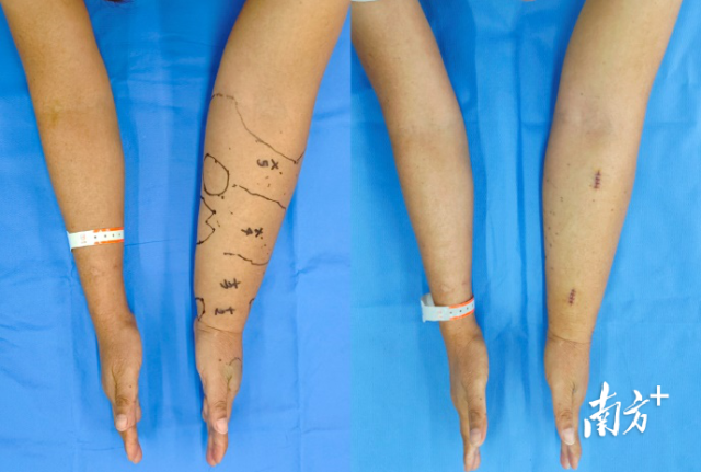 通讯员 二医 供图